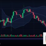 Forex Trailing Stop ล็อคกำไรตามราคา 2569
